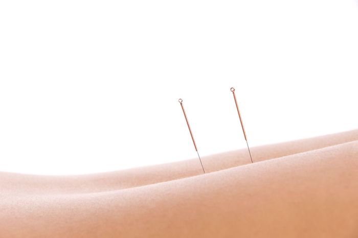 Jennie Chew of Essence of Healing Acupuncture in Chafford Hundred