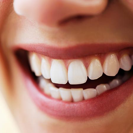 Smile Gallery