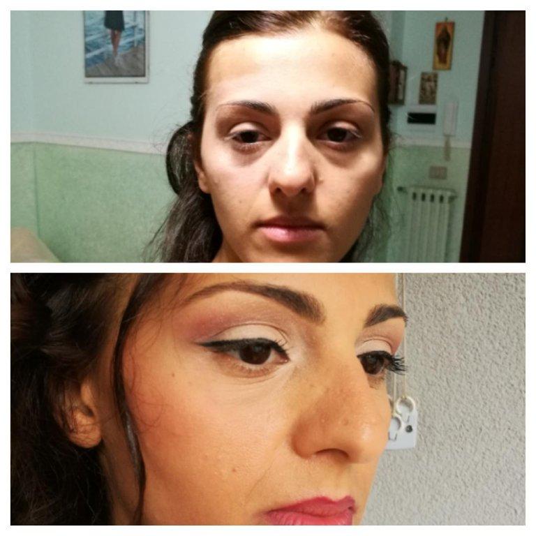 FOTO49