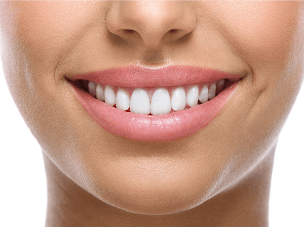 Sorriso Harmônico Após a Cirurgia de Sorriso Gengival Sorriso Harmônico Após a Cirurgia de Sorriso Gengival