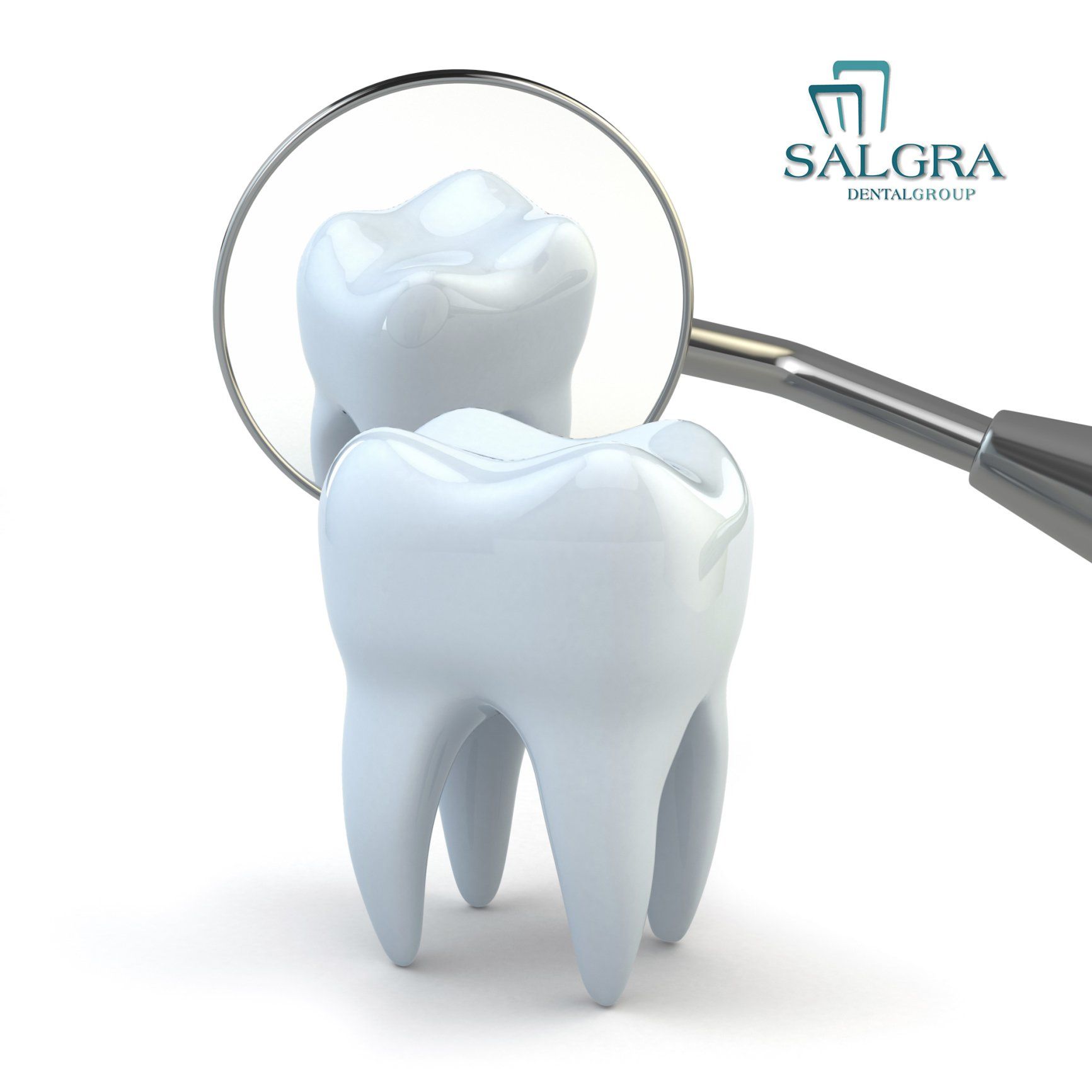 Sealants Dental Sealants