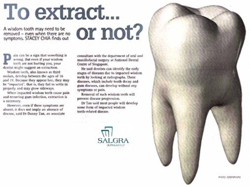 Salgra Dental Teeth Extraction Tooth Extraction