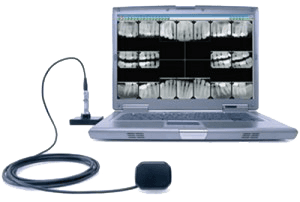 Laptop displaying dental X-rays beside a connected intraoral scanner and cable