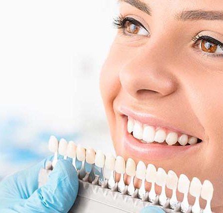 Woman smiling during a teeth shade check with a dentist's color guide