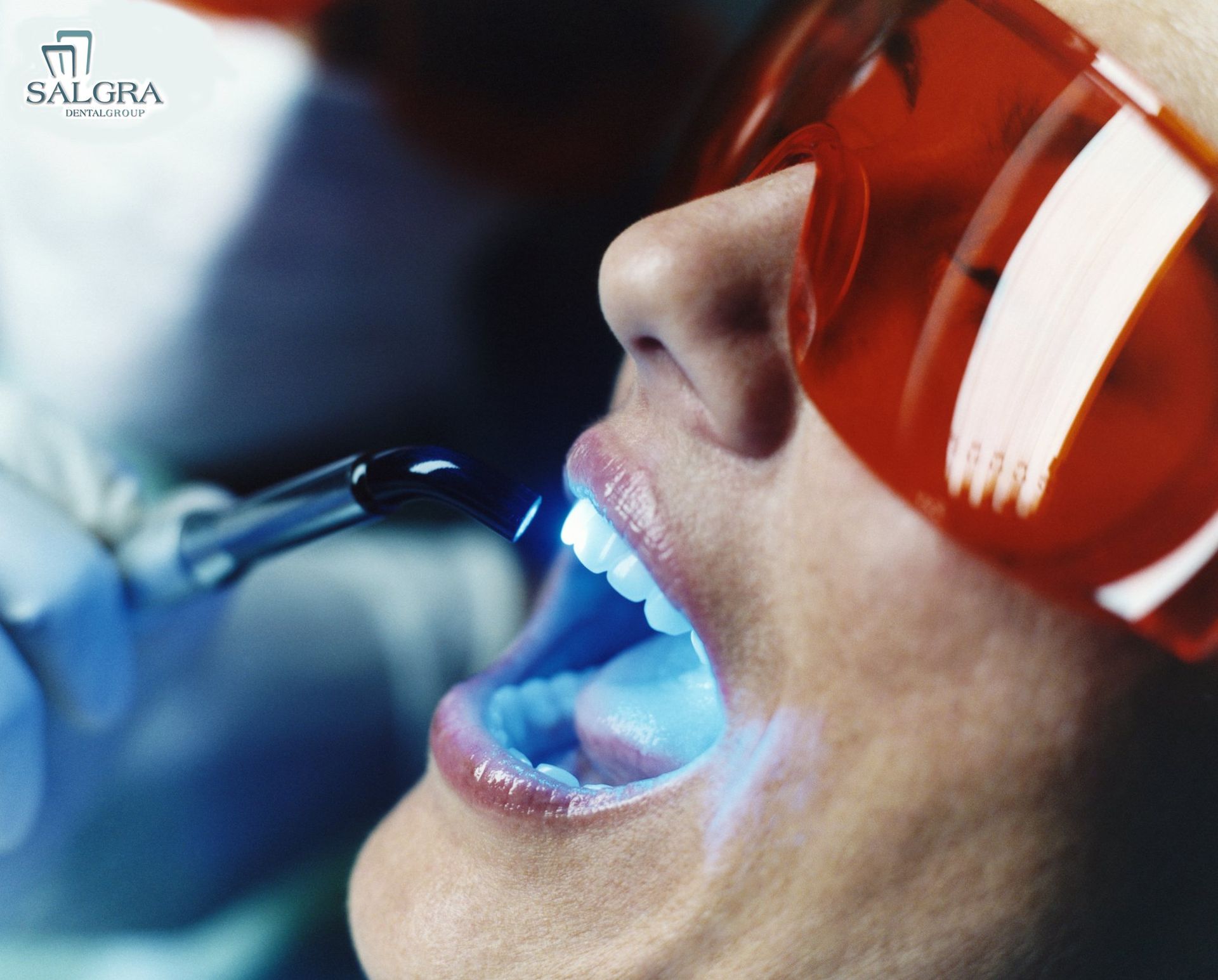 Salgra Dental Teeth Whitening Pembroke Pines Teeth Whitening