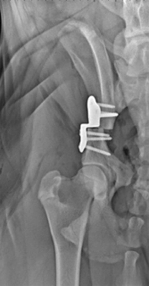 Lastra di una radiografia ossea