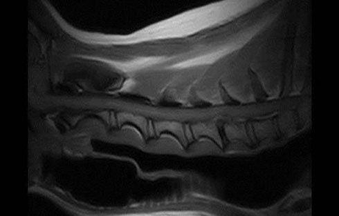 Radiografia
