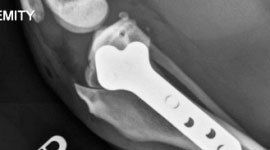 Radiografia ossea