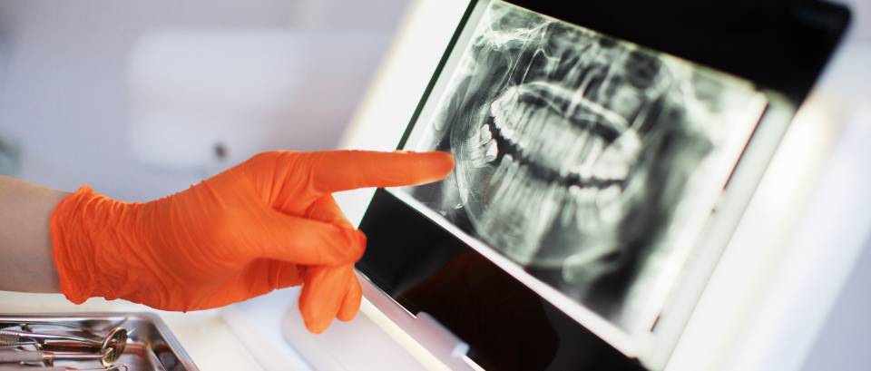 radiografia dentale
