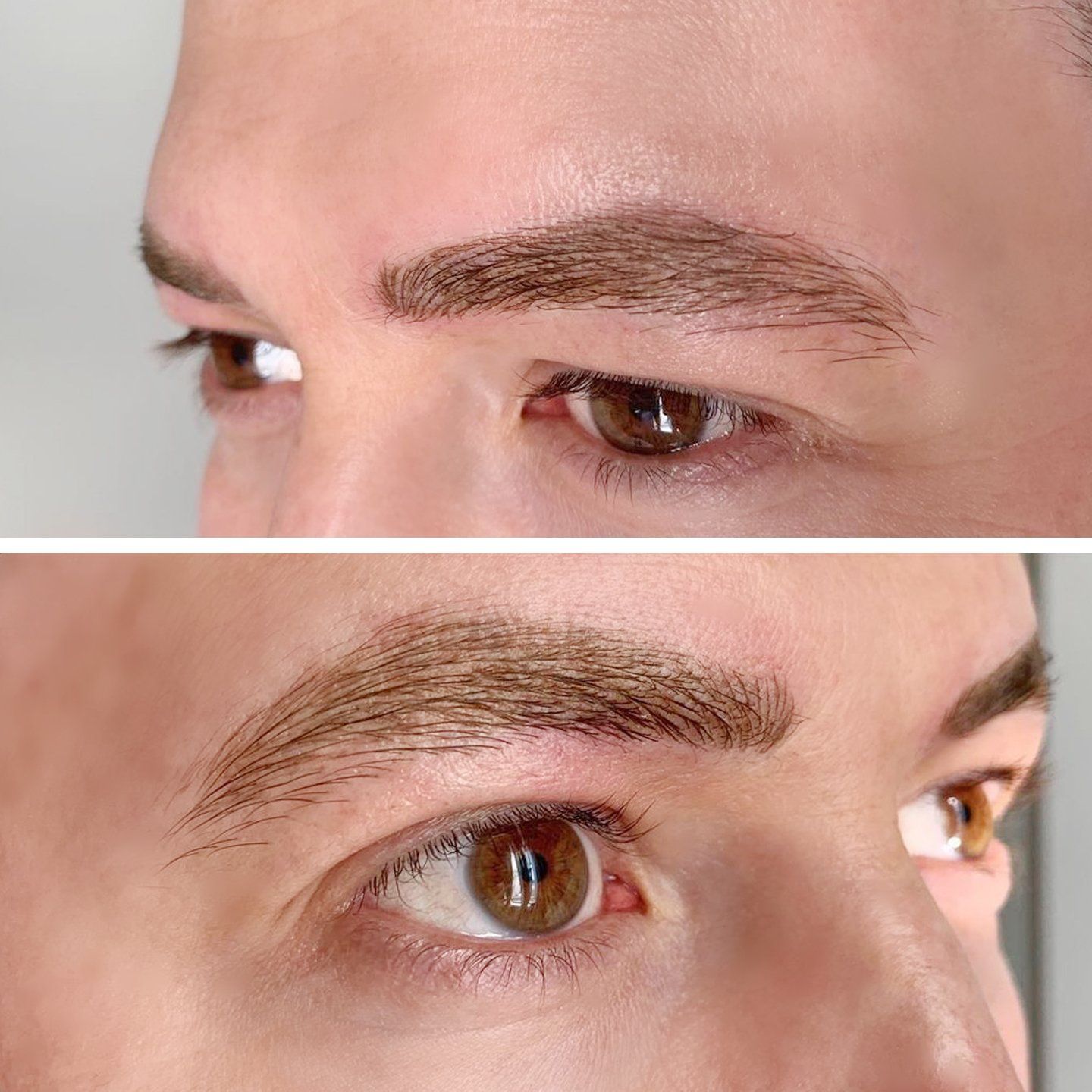 Eyebrow Enhancement