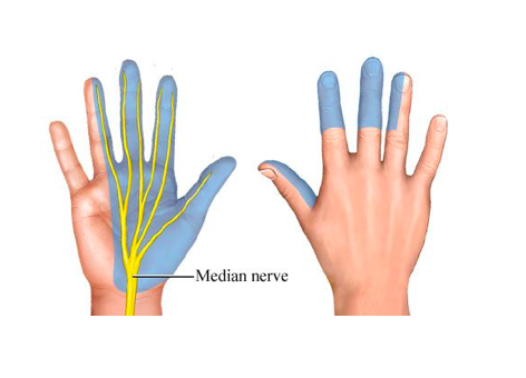 medianus