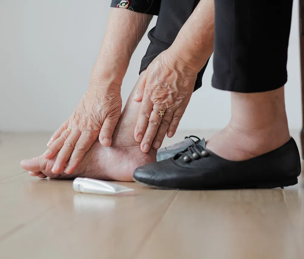 Swollen Feet - Acacia Podiatry in Parap, NT