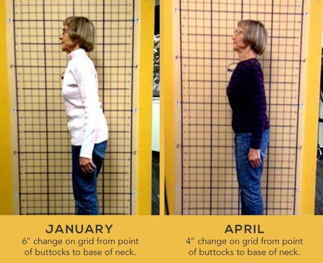 Benefits of Good Posture