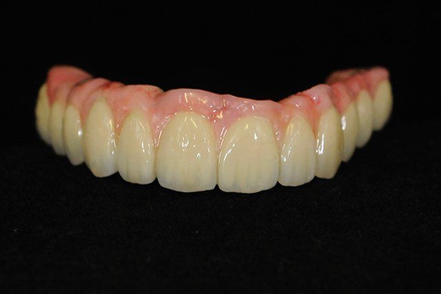 teeth replacement treatment