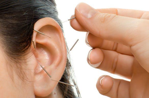 Acupoint Family Wellness Auricular Acupuncture