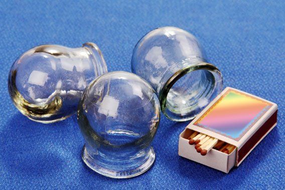 Acupoint Family Wellness Cupping Supplies