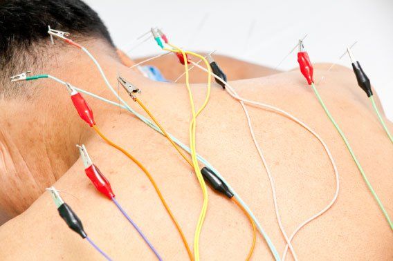 Acupoint Family Wellness Electro-Acupuncture