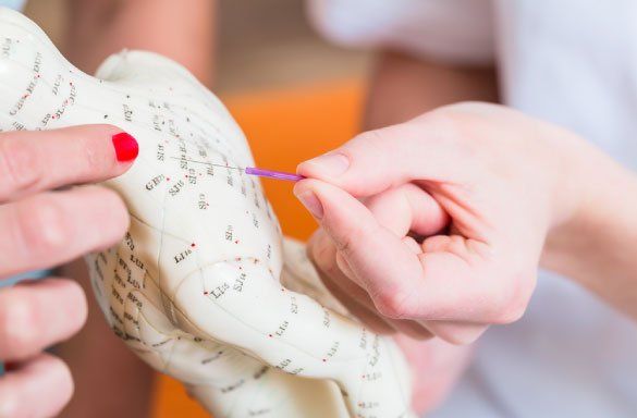 Acupoint Family Wellness Meridian Acupuncture