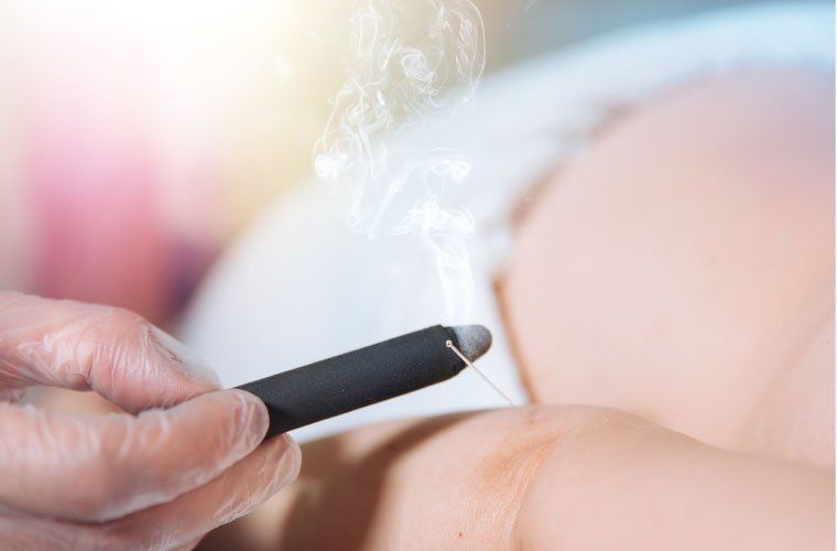 Acupoint Family Wellness Moxibustion