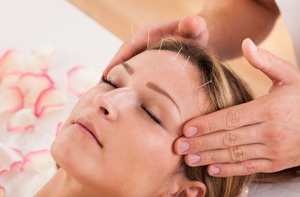 Acupoint Family Wellness Shu Scalp Acupunture
