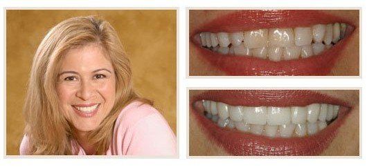 before and after - patient 10