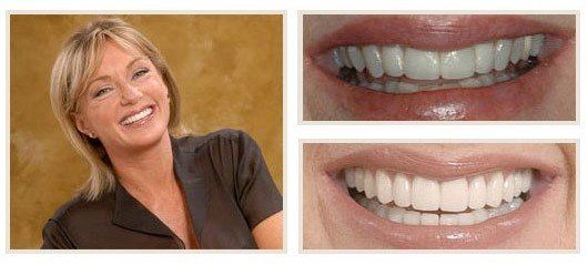 before and after - patient 6