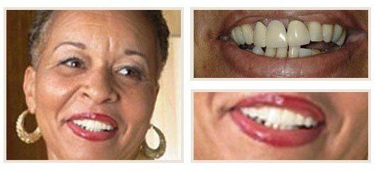 before and after - patient 7