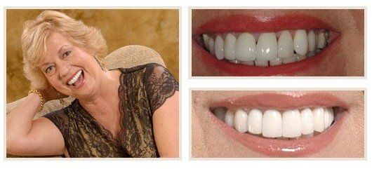 before and after - patient 19