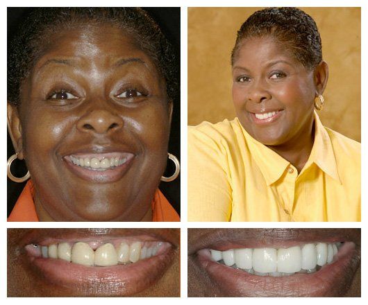 Stephanie's before and after