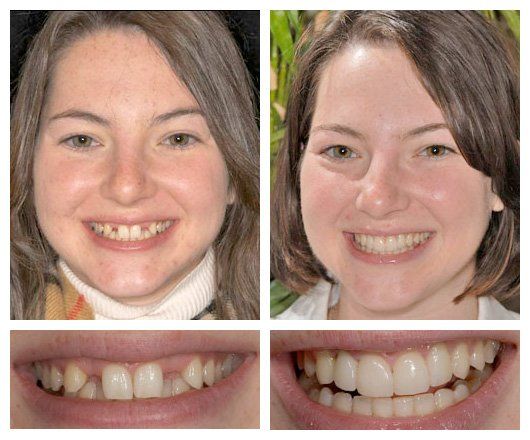 Stephanie's before and after
