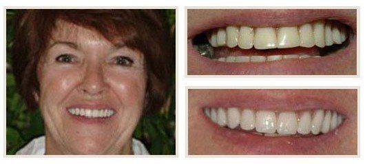 before and after - patient 8