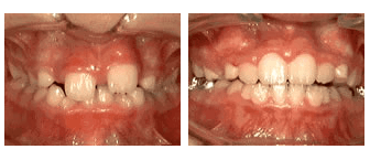 phase-one - before and after