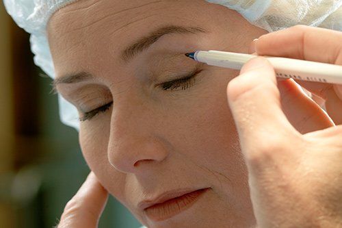 a patient preparing for cosmetic surgery