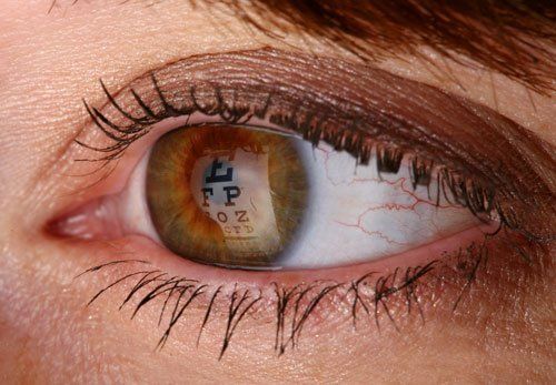 An eye