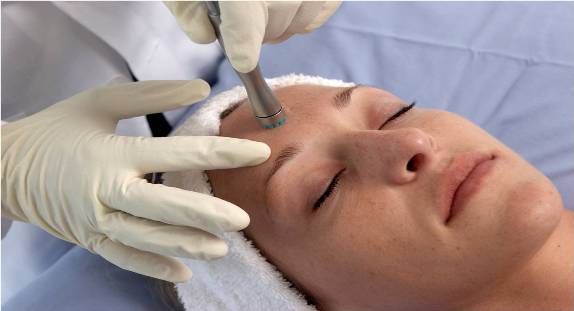 chemical-peel