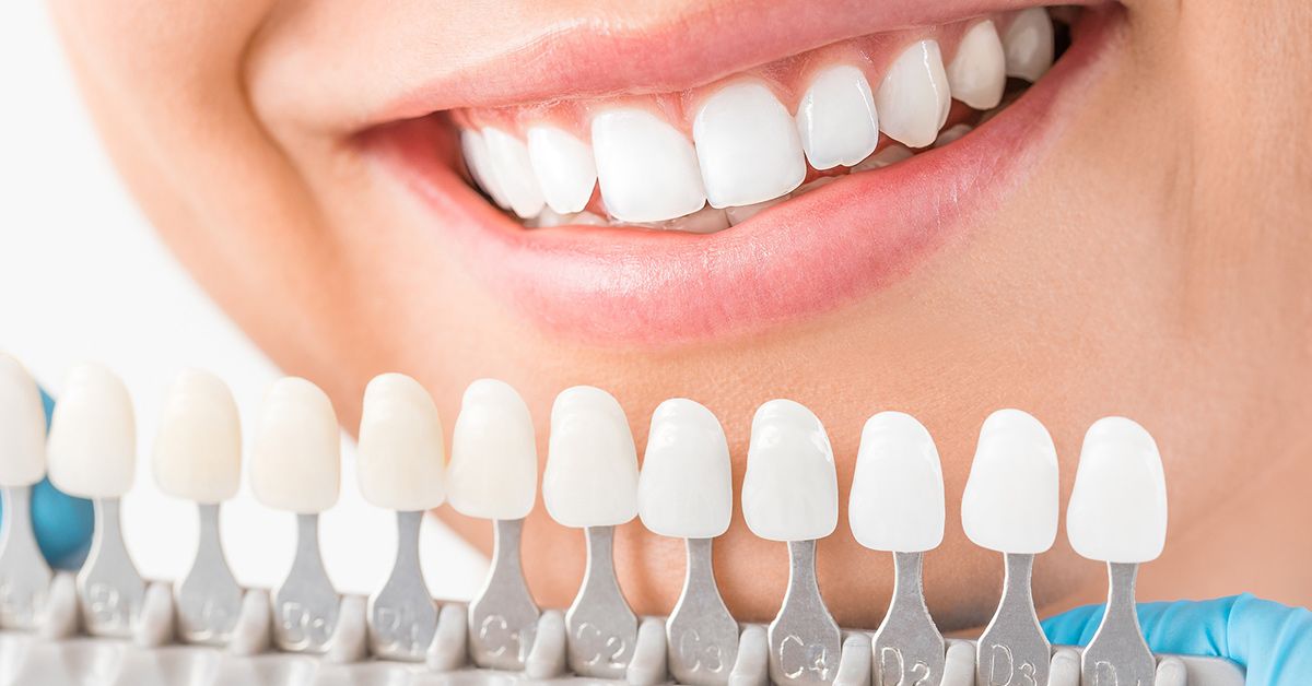 benefits of dental implants