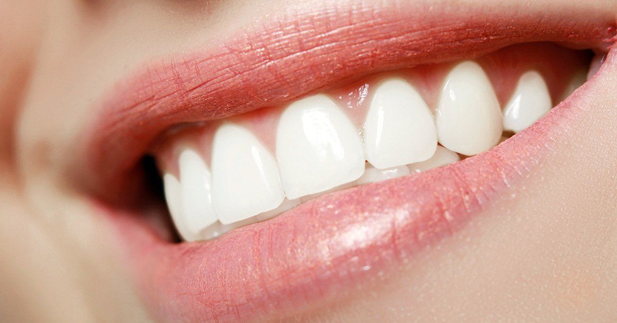 invisalign