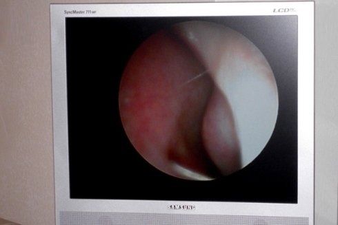 audiometria