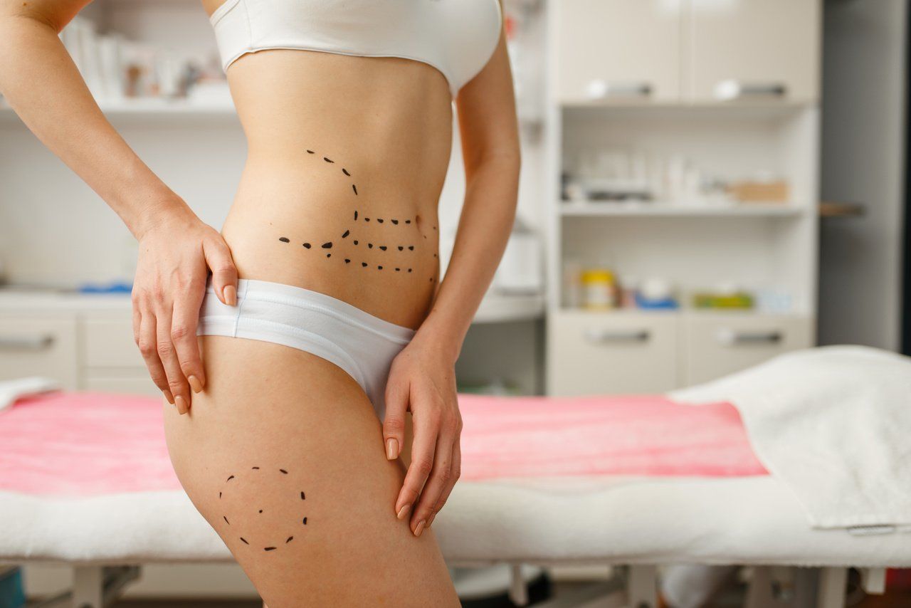 Cirurgia pós-bariátrica