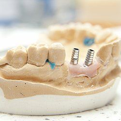 denture repairs