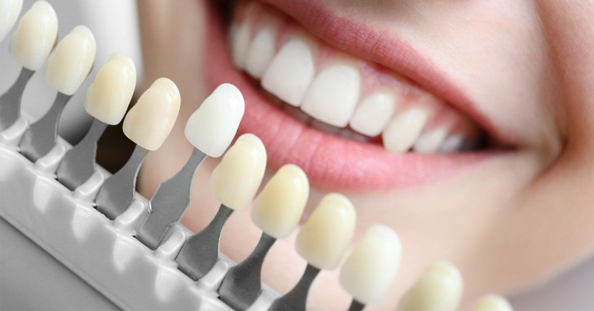 teeth Whitening Shade