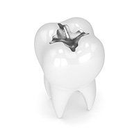 dental filling
