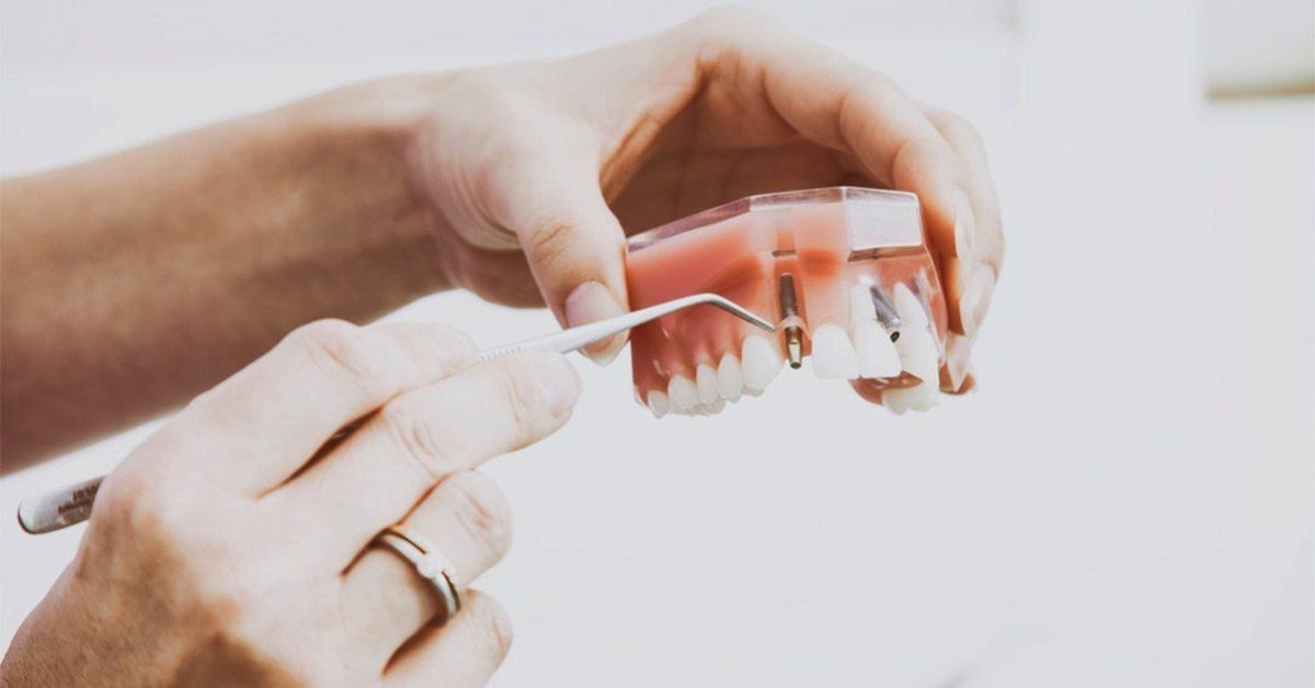 full mouth rehabilitation