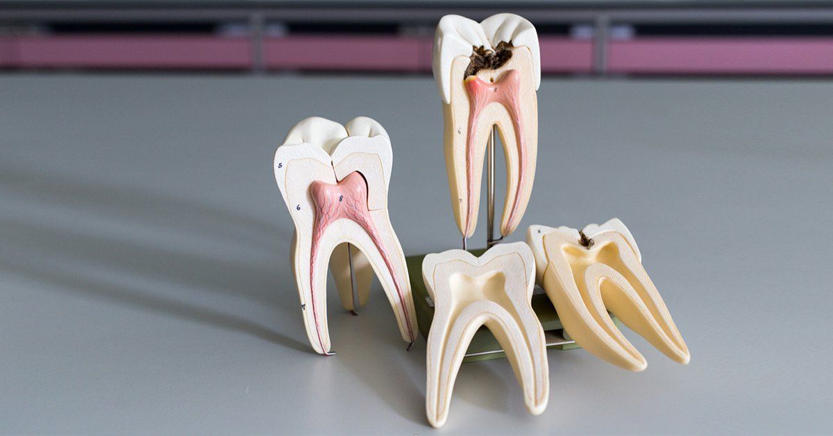 Teeth Whitening Aftercare