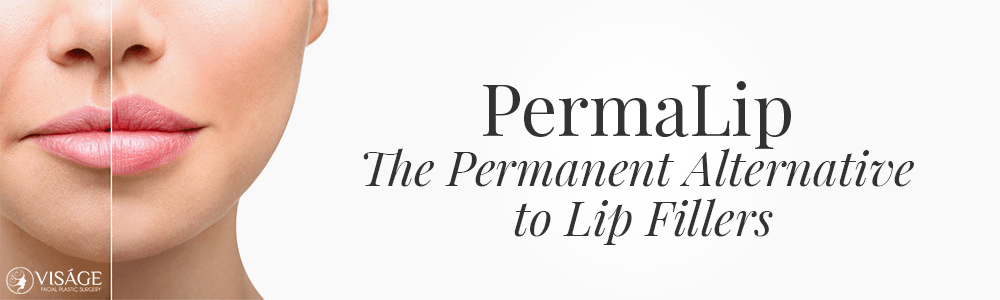 PermaLip implant + permanent lip fillers
