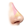 bridge rhinoplasty