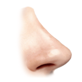 overprojected nasal tip graphic