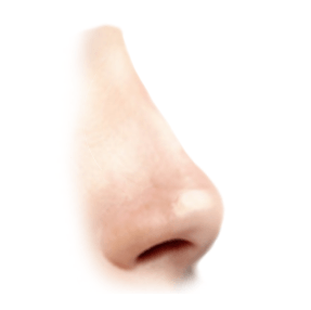 underprojected nasal tip graphic