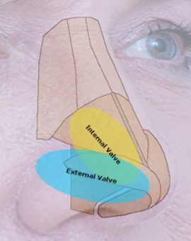 nasal valve graphic