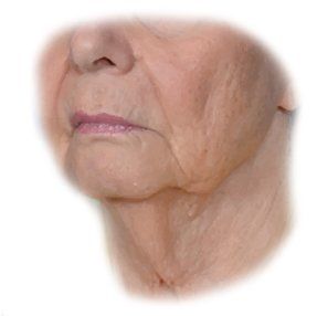 image of old woman's jowls